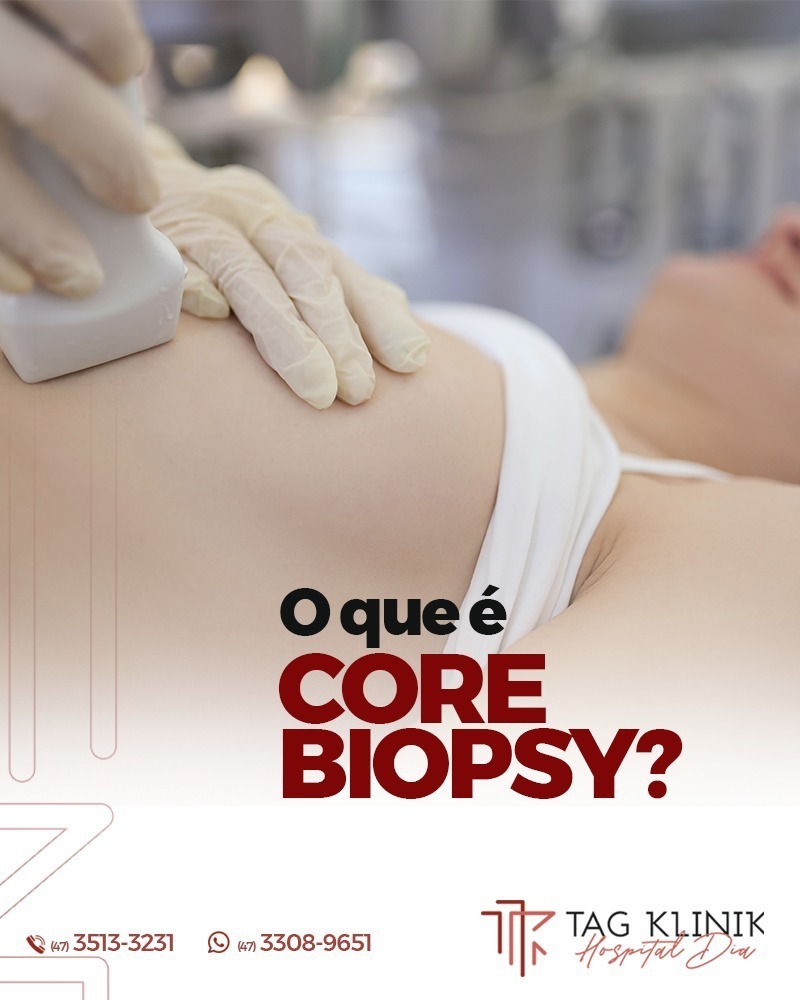Você sabe o que é Core Biopsy?