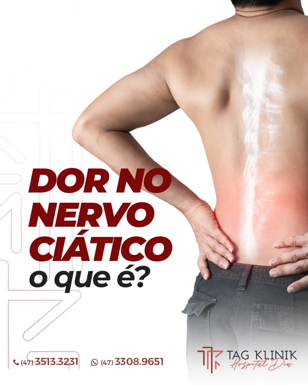 Dor no Nervo Ciático. O que é?
