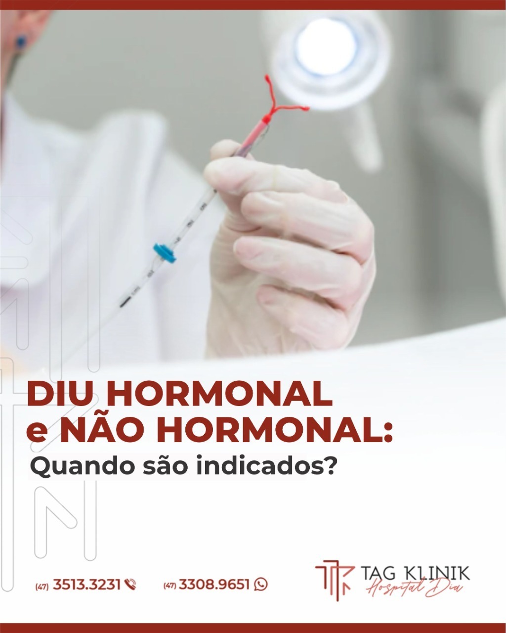 DIU hormonal e DIU não hormonal
