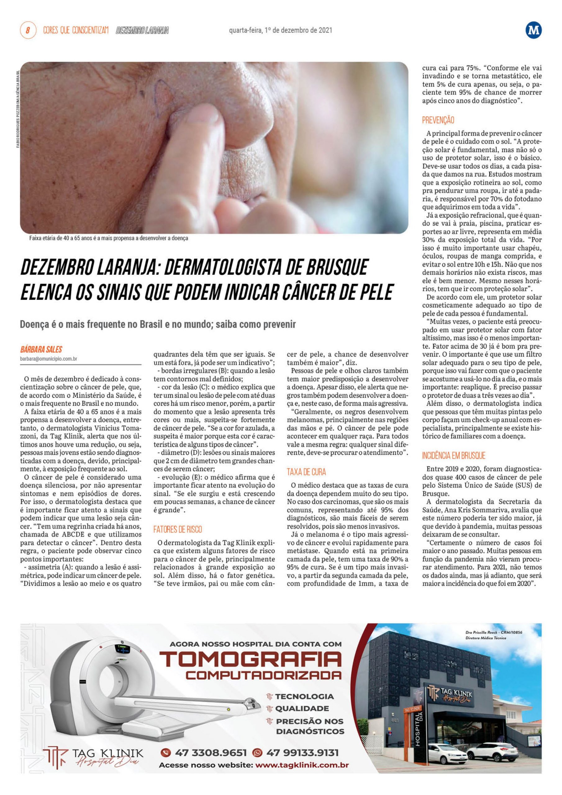 TAG NEWS: Dezembro Laranja: quais os sinais podem indicar câncer de pele?