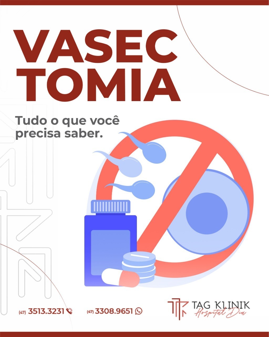 Vasectomia: tudo o que você precisa saber.