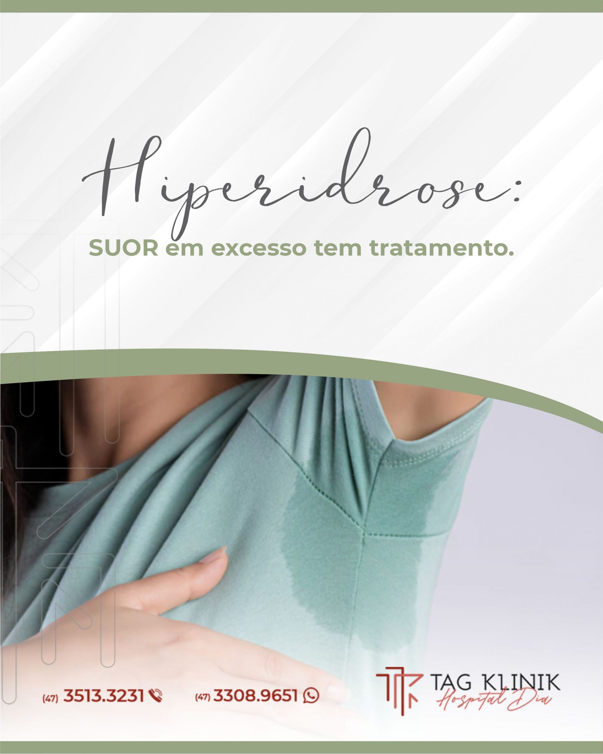 Hiperidrose: suor em excesso tem tratamento.