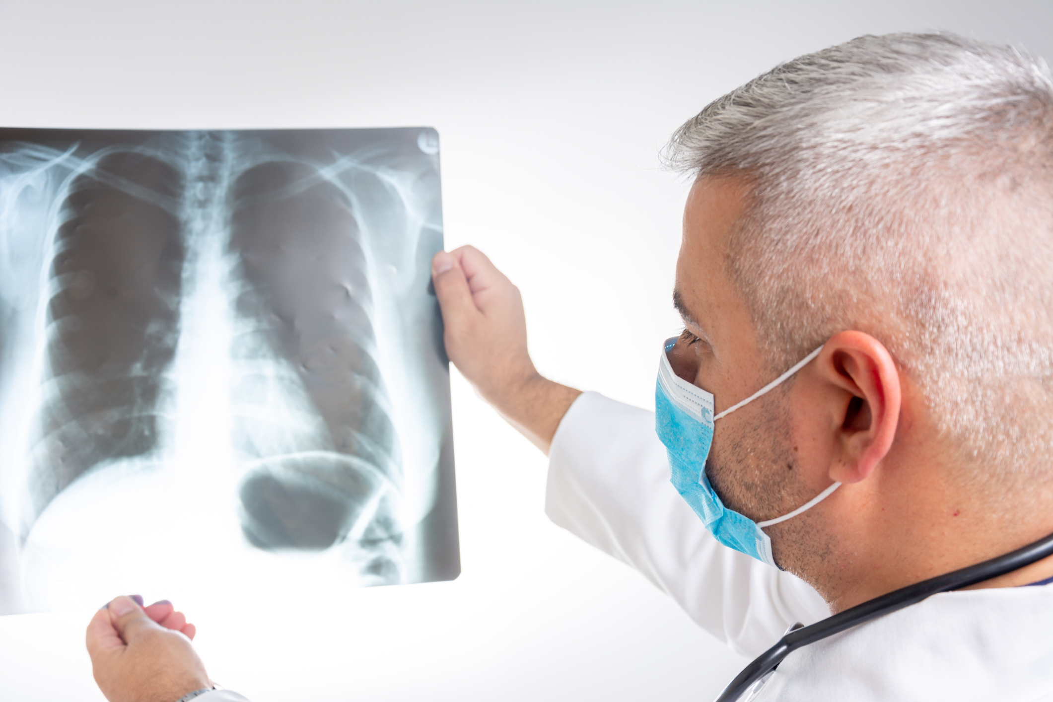 Combatendo o Câncer de Pulmão: Prevenção, Inovação e Esperança nos pacientes da TAG KLINIK – Hospital Dia.